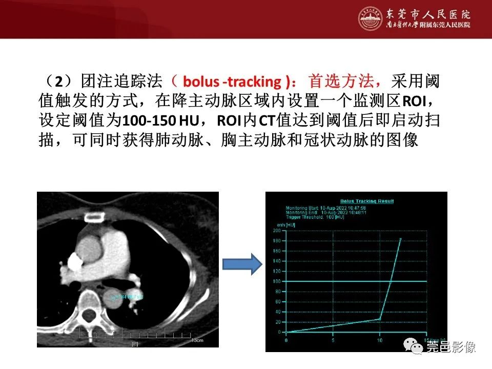 影像PPT - 【PPT】胸痛三联征CT扫描技术-25