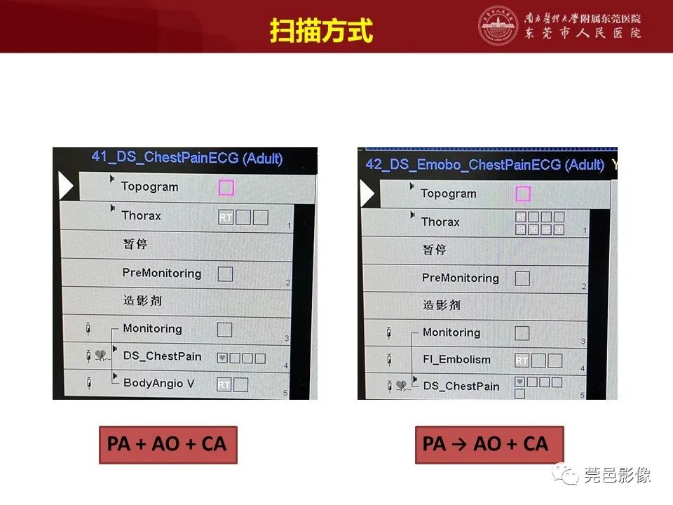 影像PPT - 【PPT】胸痛三联征CT扫描技术-28