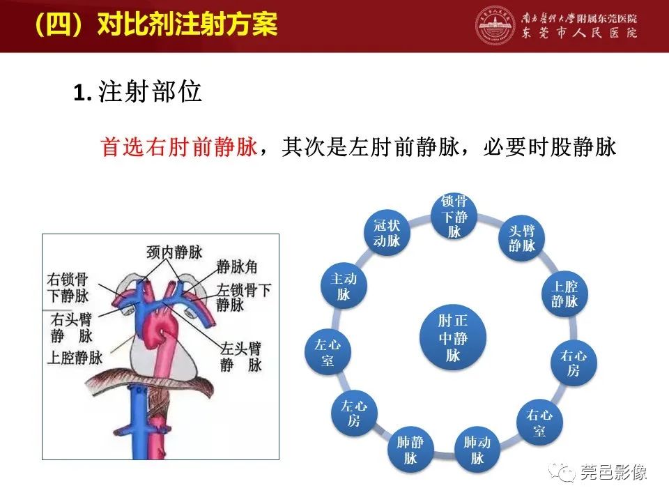 影像PPT - 【PPT】胸痛三联征CT扫描技术-29
