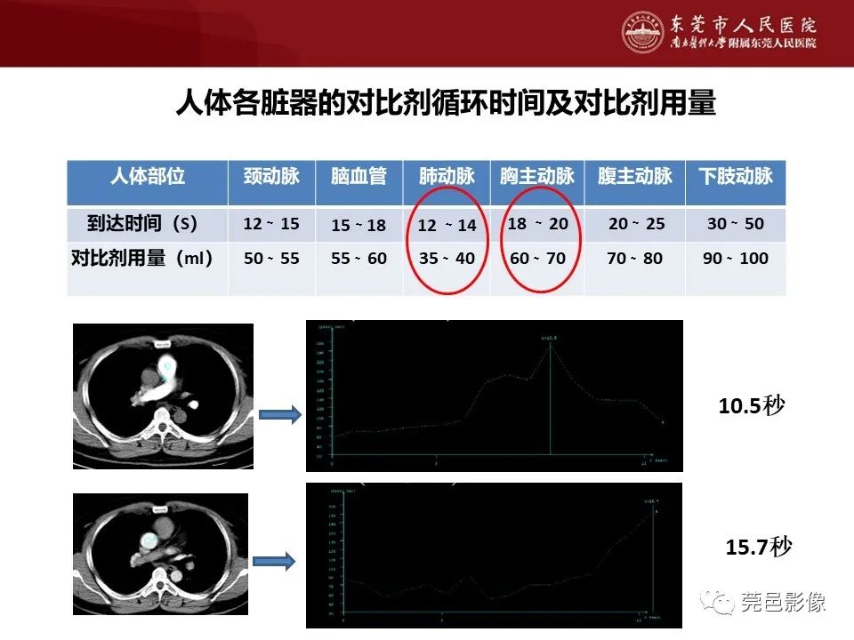 影像PPT - 【PPT】胸痛三联征CT扫描技术-33