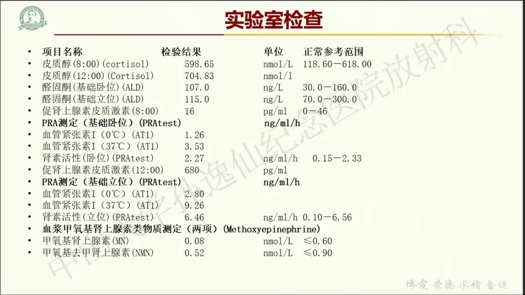 影像PPT - 【病例】肾上腺皮质腺癌1例CT及MR影像-3