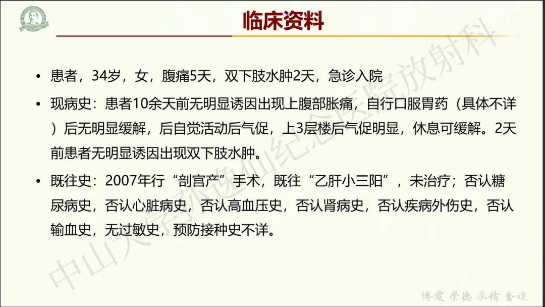 影像PPT - 【病例】肾上腺皮质腺癌1例CT及MR影像-2