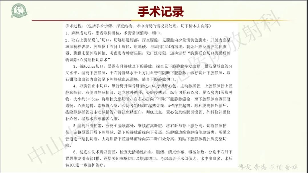 影像PPT - 【病例】肾上腺皮质腺癌1例CT及MR影像-10
