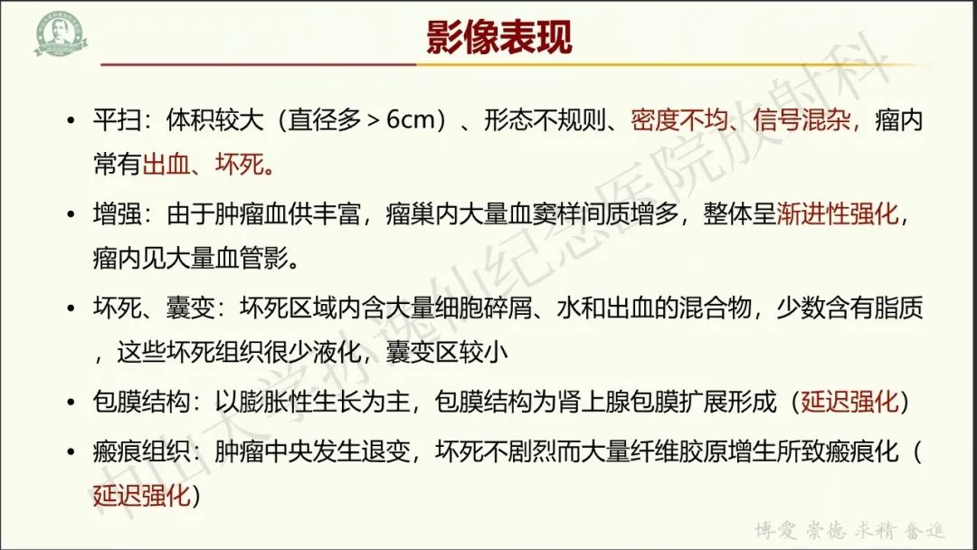 影像PPT - 【病例】肾上腺皮质腺癌1例CT及MR影像-13