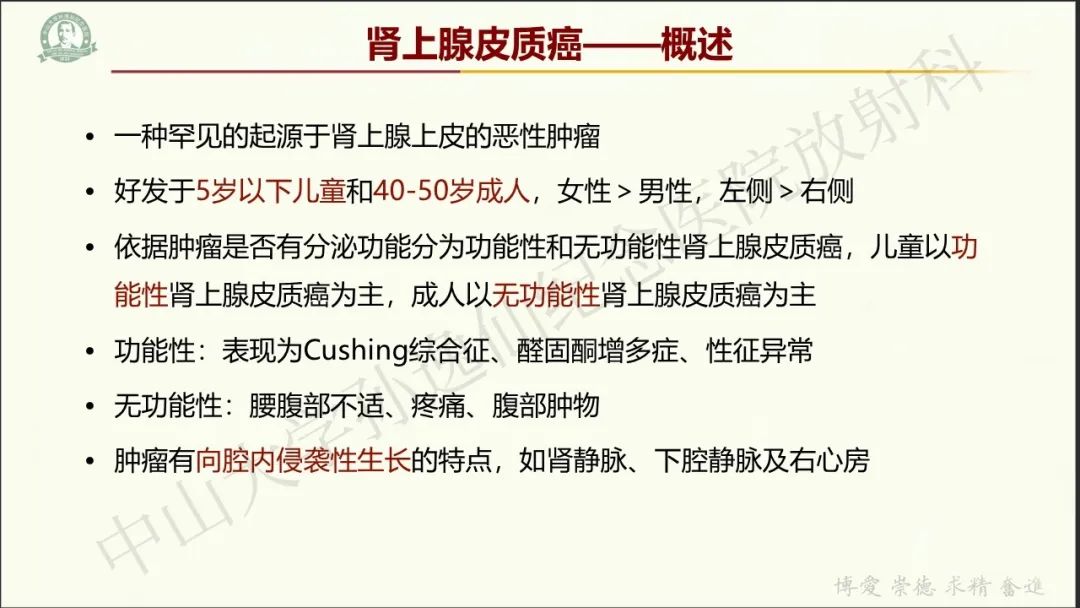 影像PPT - 【病例】肾上腺皮质腺癌1例CT及MR影像-12