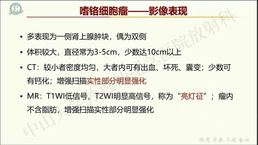 影像PPT - 【病例】肾上腺皮质腺癌1例CT及MR影像-18