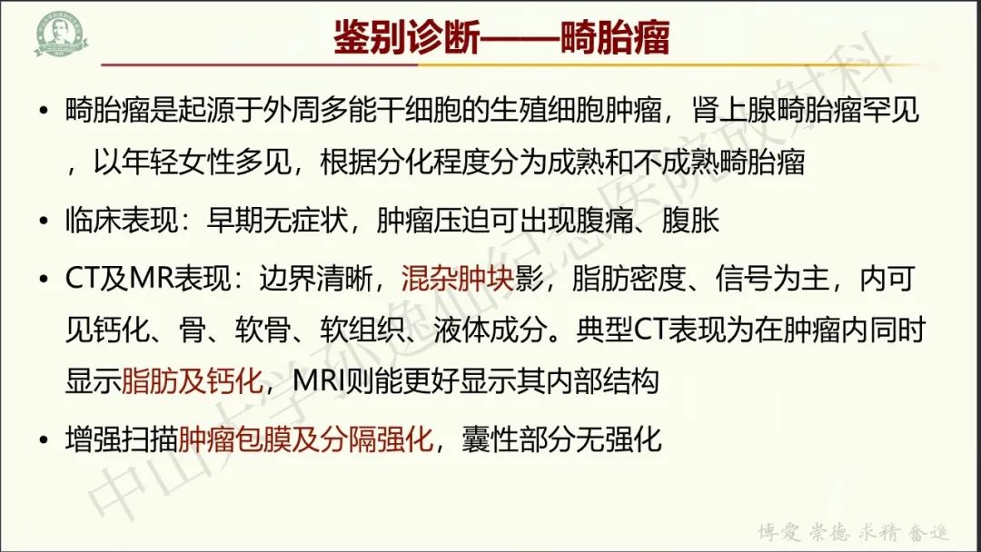 影像PPT - 【病例】肾上腺皮质腺癌1例CT及MR影像-26