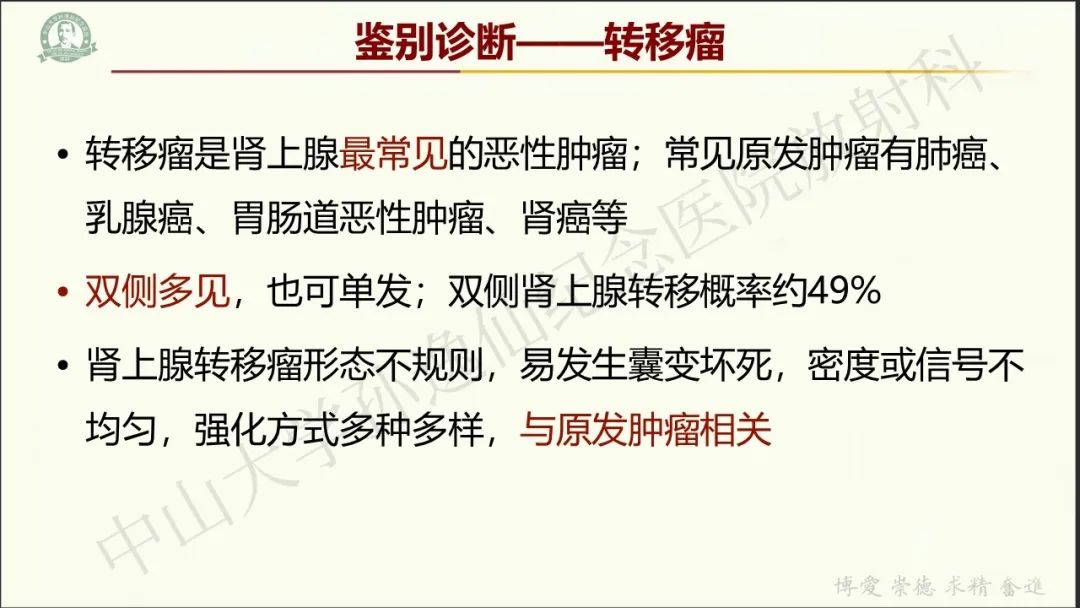 影像PPT - 【病例】肾上腺皮质腺癌1例CT及MR影像-33