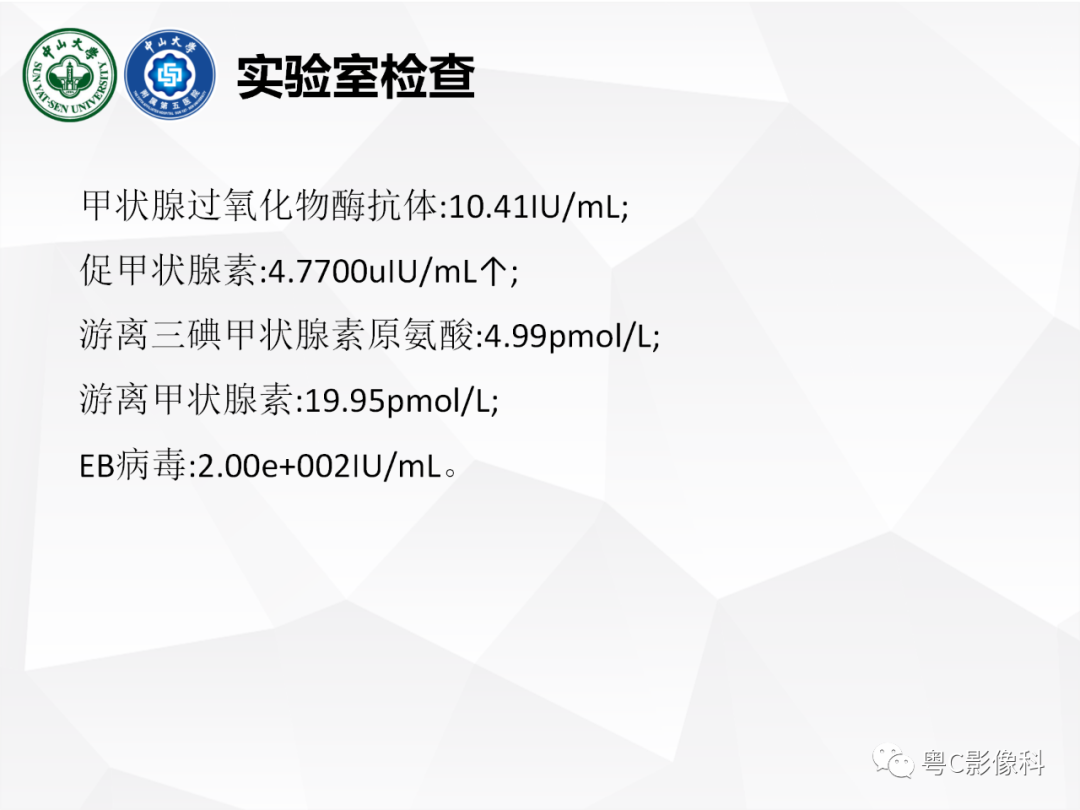 影像PPT - 【病例】颅底脊索瘤1例CT及MR影像表现及鉴别诊断-3