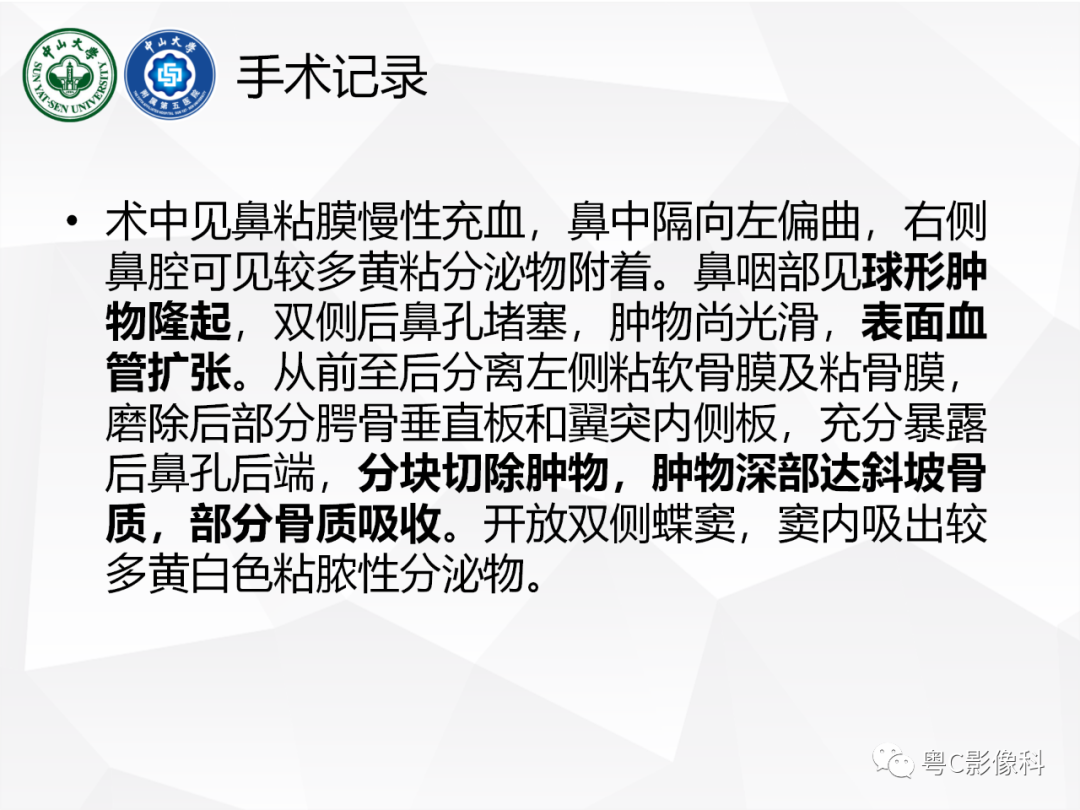 影像PPT - 【病例】颅底脊索瘤1例CT及MR影像表现及鉴别诊断-18