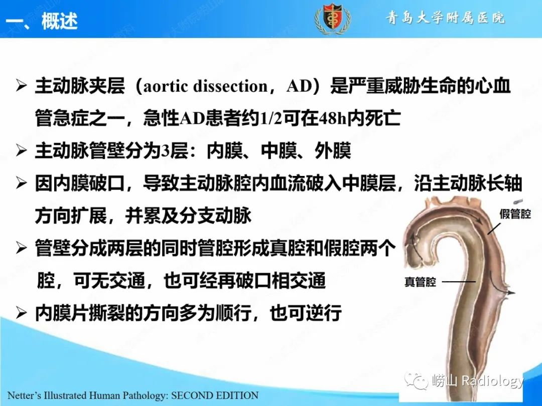 影像PPT - 【PPT】主动脉夹层的CT征象及临床意义再认识-3