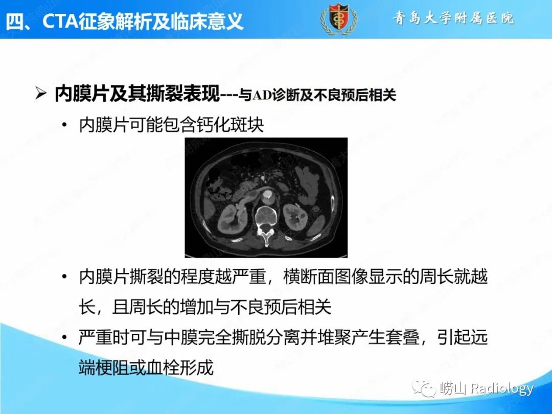 影像PPT - 【PPT】主动脉夹层的CT征象及临床意义再认识-10