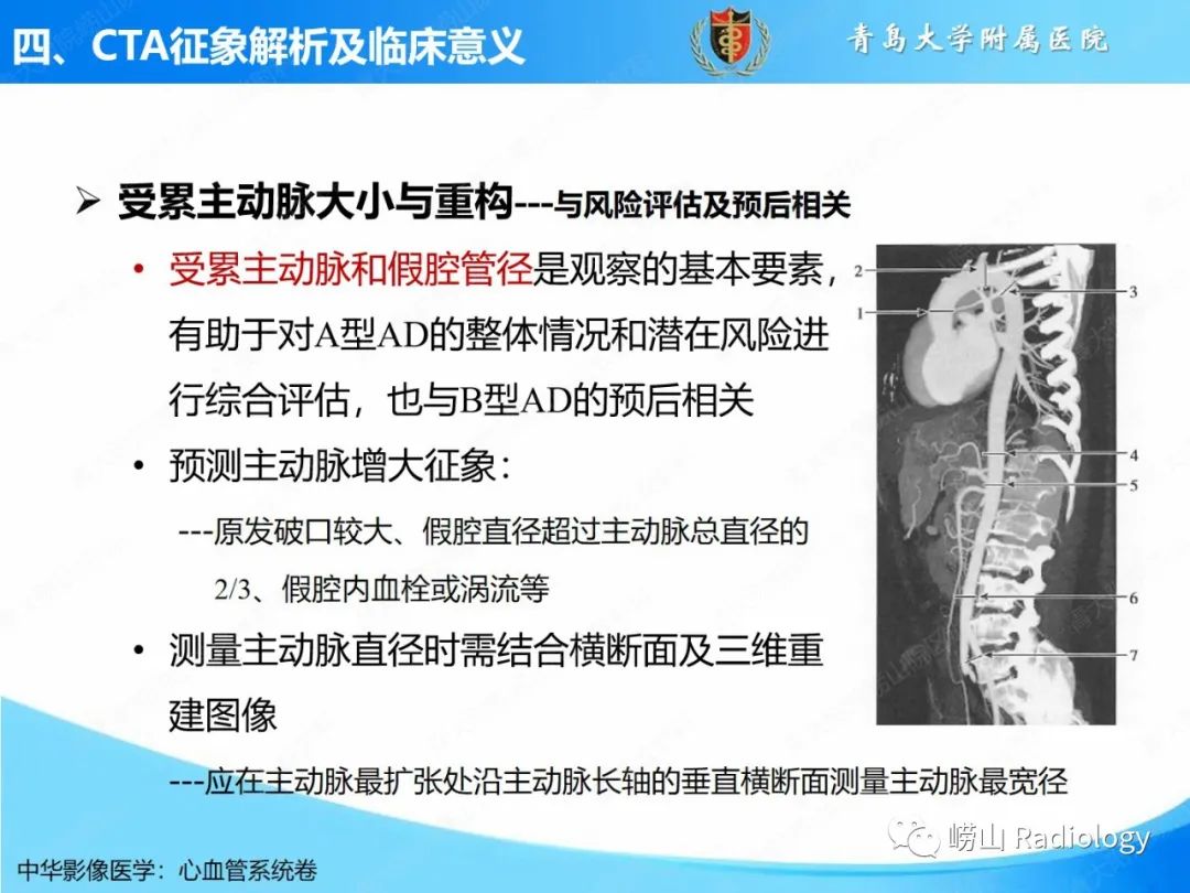 影像PPT - 【PPT】主动脉夹层的CT征象及临床意义再认识-13