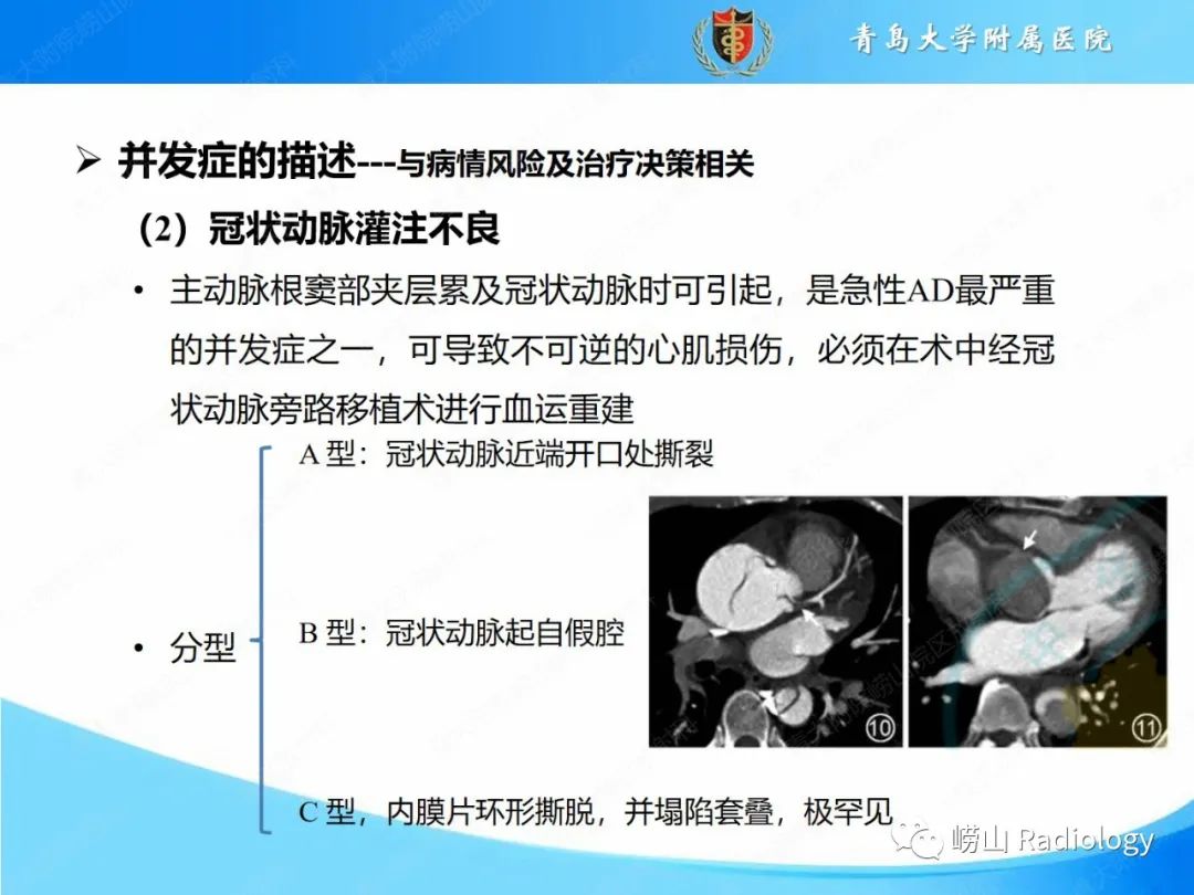 影像PPT - 【PPT】主动脉夹层的CT征象及临床意义再认识-19