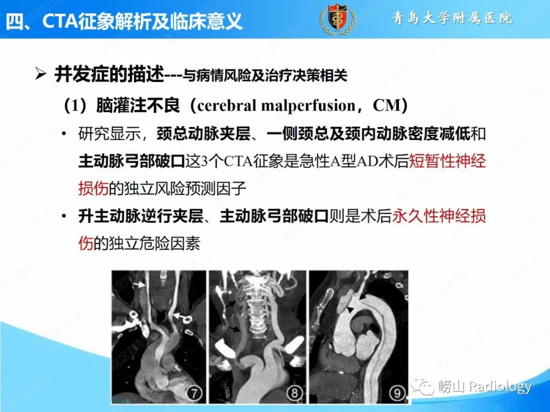 影像PPT - 【PPT】主动脉夹层的CT征象及临床意义再认识-18