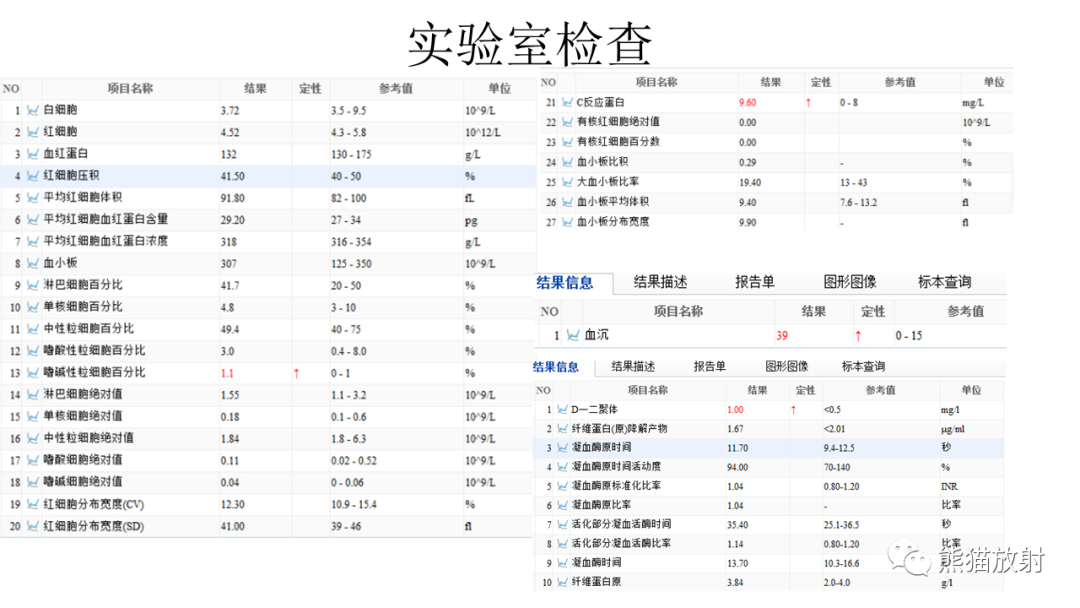 影像PPT - 【病例】肋骨尤文肉瘤 & 股骨骨髓炎-3