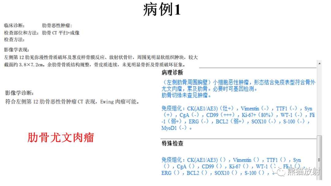 影像PPT - 【病例】肋骨尤文肉瘤 & 股骨骨髓炎-13