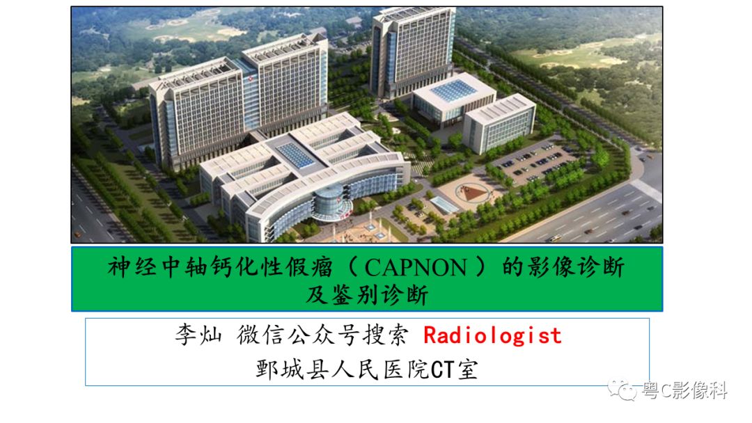 影像PPT - 【PPT】神经中轴钙化性假瘤(CAPNON)的影像诊断及鉴别诊断-1