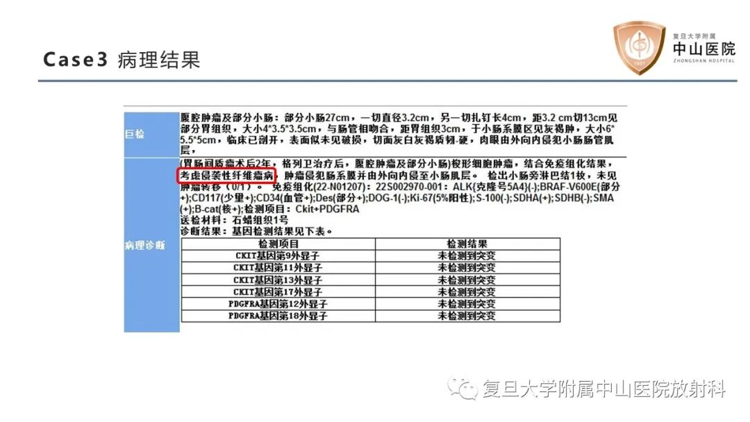 影像PPT - 【病例】肠系膜孤立性肿块3例CT影像鉴别-13