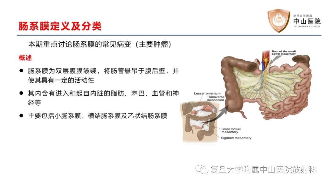影像PPT - 【病例】肠系膜孤立性肿块3例CT影像鉴别-14