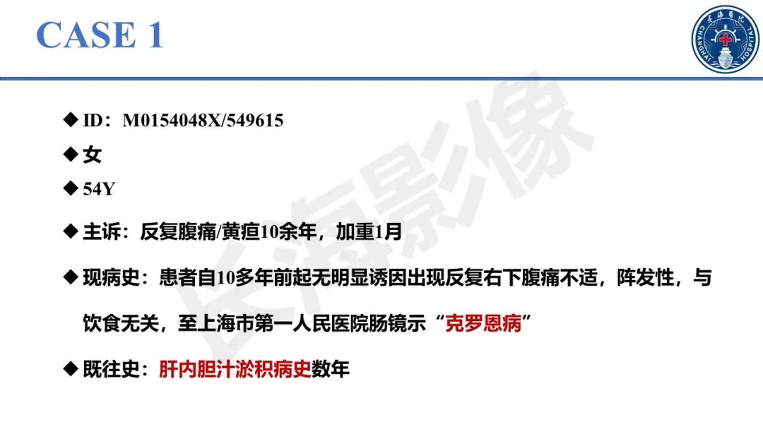 影像PPT - 【PPT】原发性硬化性胆管炎-2