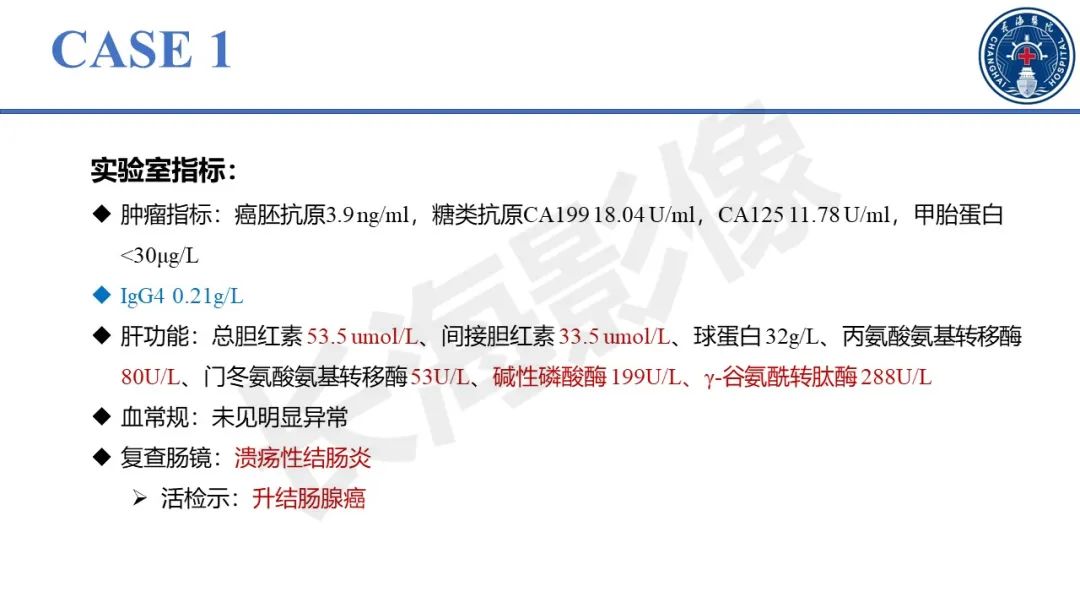 影像PPT - 【PPT】原发性硬化性胆管炎-3