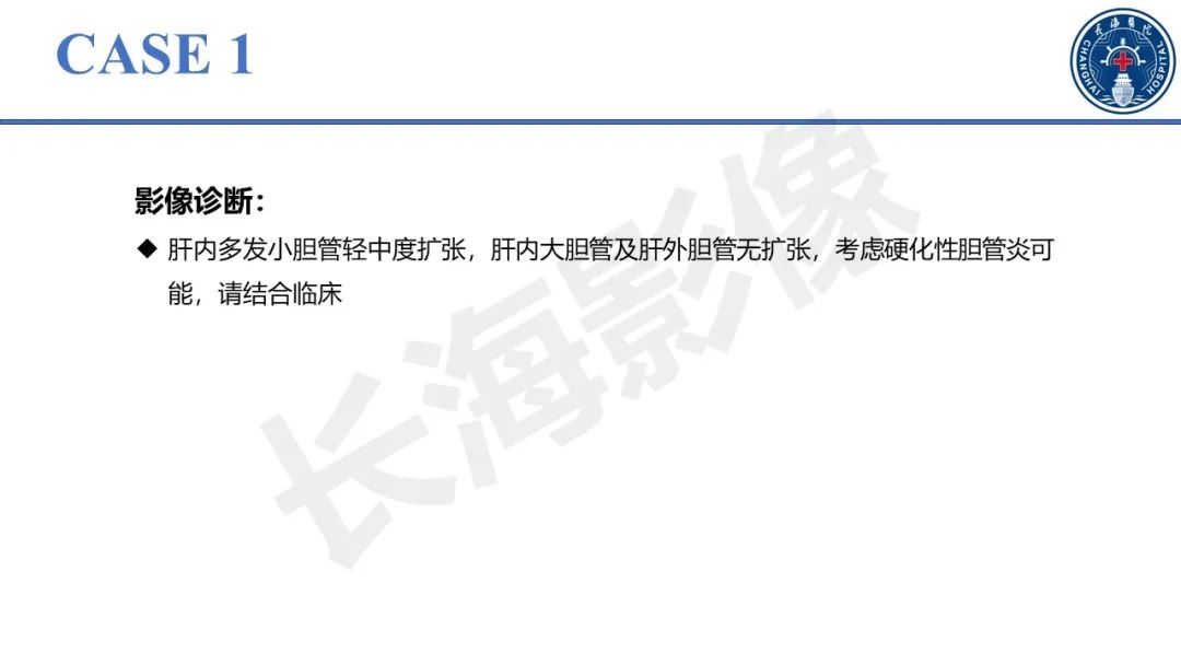 影像PPT - 【PPT】原发性硬化性胆管炎-6