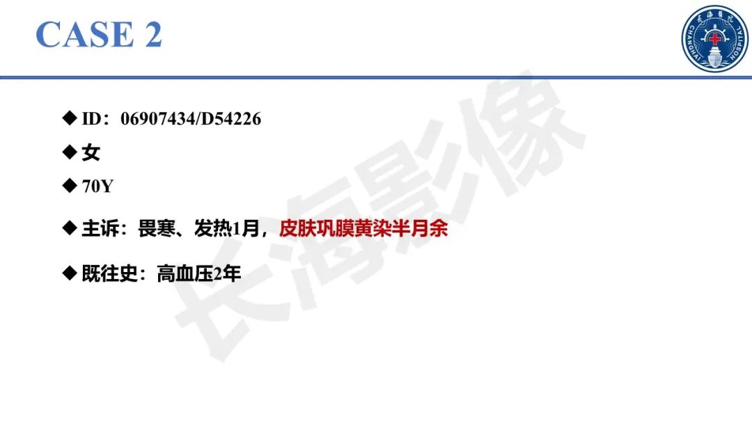 影像PPT - 【PPT】原发性硬化性胆管炎-12