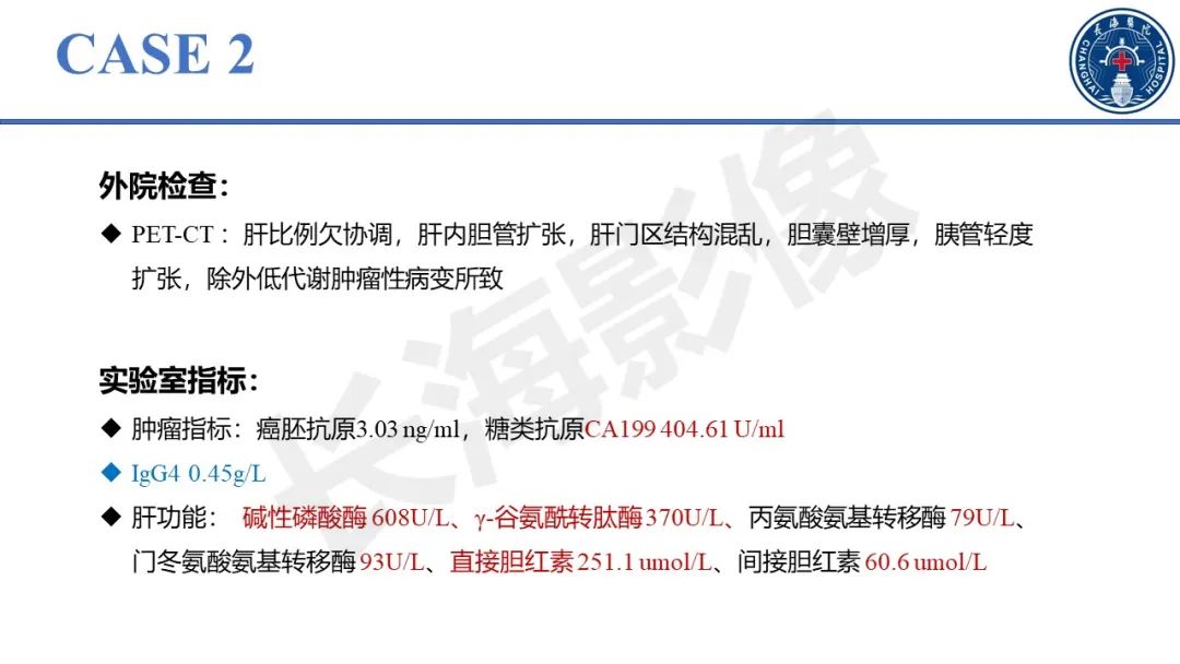 影像PPT - 【PPT】原发性硬化性胆管炎-13