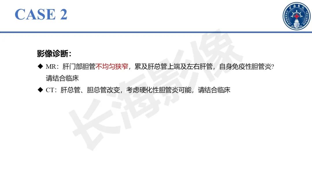 影像PPT - 【PPT】原发性硬化性胆管炎-18