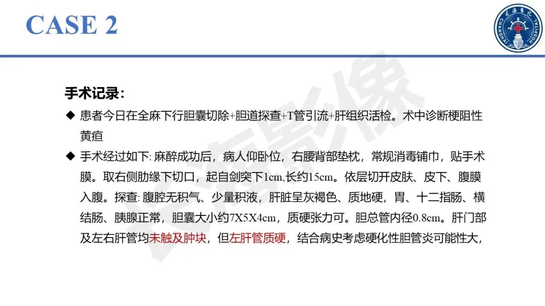 影像PPT - 【PPT】原发性硬化性胆管炎-19
