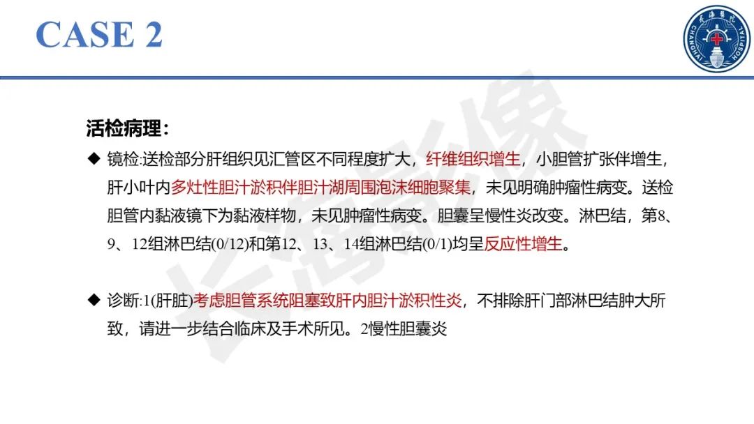 影像PPT - 【PPT】原发性硬化性胆管炎-20