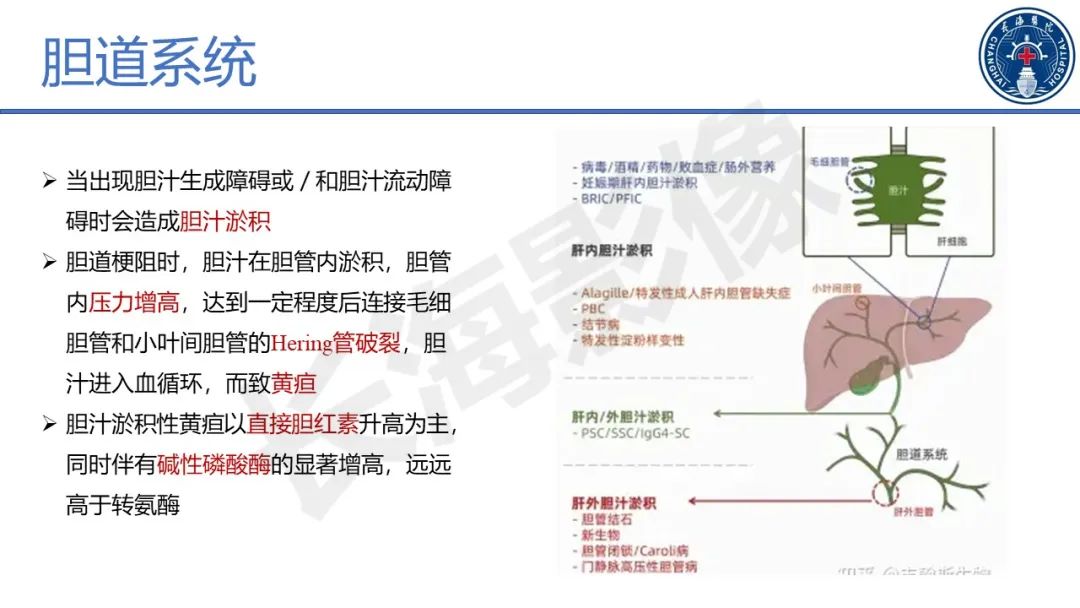 影像PPT - 【PPT】原发性硬化性胆管炎-24
