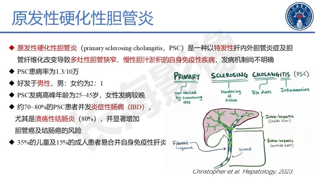 影像PPT - 【PPT】原发性硬化性胆管炎-25