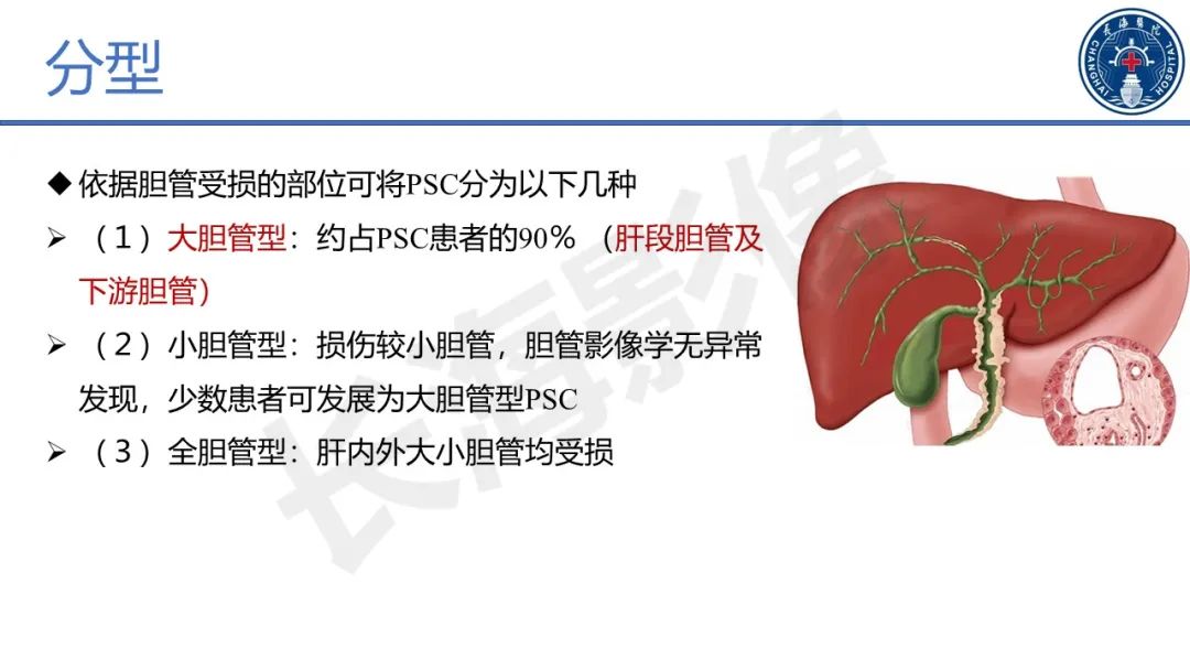 影像PPT - 【PPT】原发性硬化性胆管炎-26