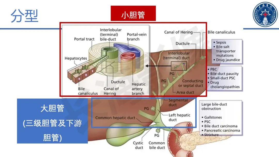 影像PPT - 【PPT】原发性硬化性胆管炎-27