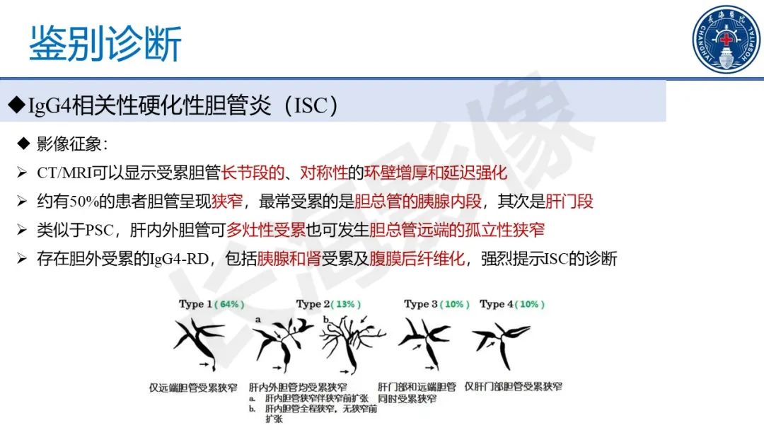 影像PPT - 【PPT】原发性硬化性胆管炎-39