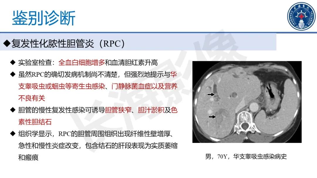 影像PPT - 【PPT】原发性硬化性胆管炎-43