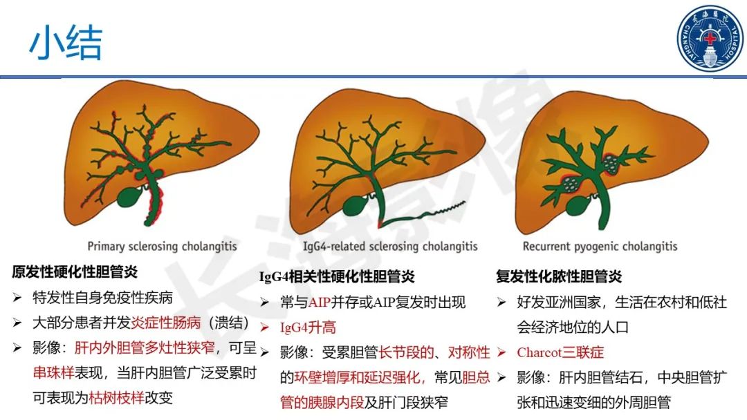 影像PPT - 【PPT】原发性硬化性胆管炎-46