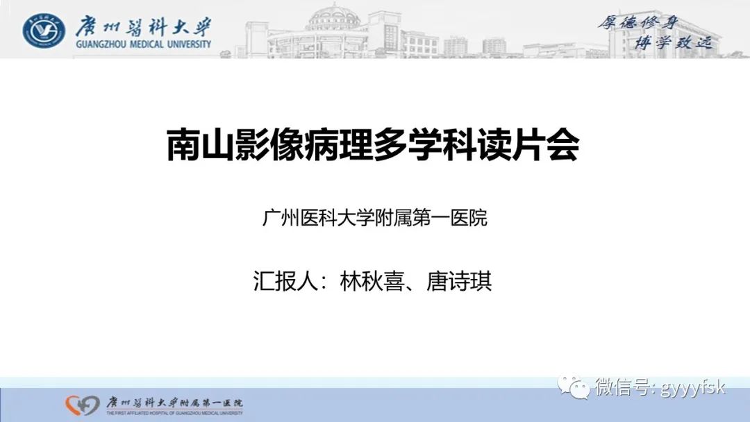 影像PPT - 【PPT】胆管导管内乳头状肿瘤-1
