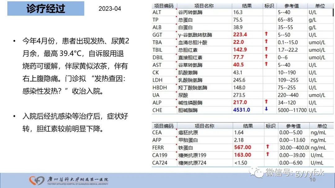 影像PPT - 【PPT】胆管导管内乳头状肿瘤-10