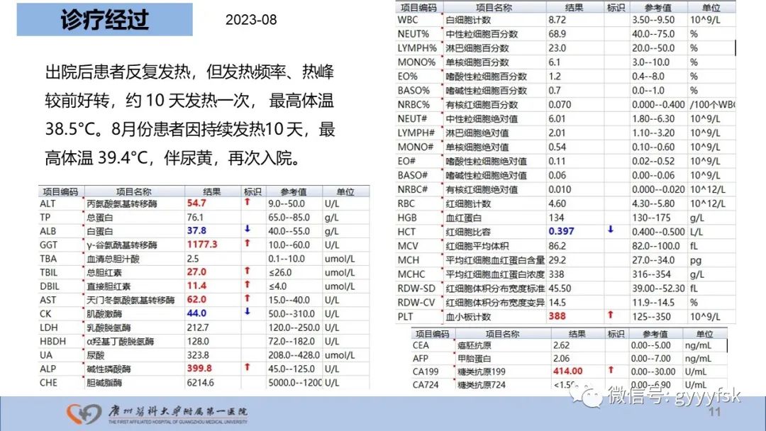 影像PPT - 【PPT】胆管导管内乳头状肿瘤-11