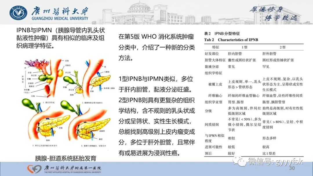 影像PPT - 【PPT】胆管导管内乳头状肿瘤-30