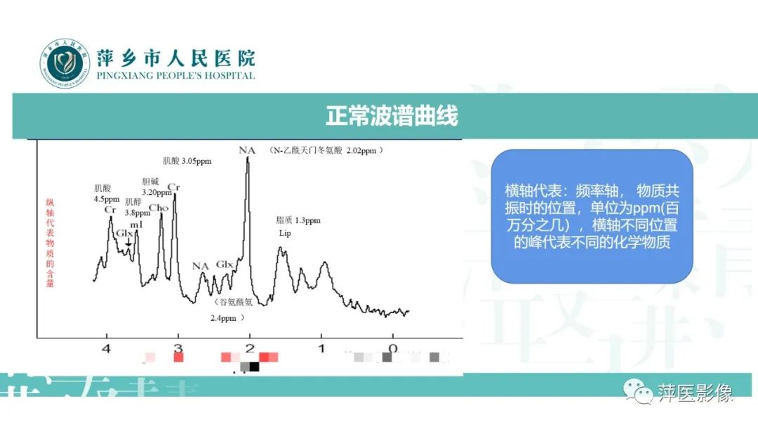 影像PPT - 【PPT】浅析脑肿瘤波谱成像-11