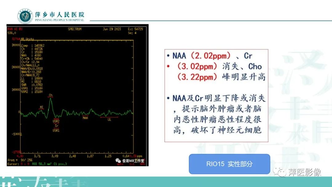 影像PPT - 【PPT】浅析脑肿瘤波谱成像-29