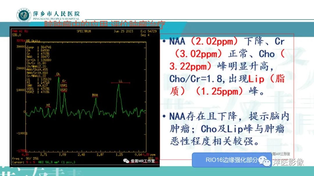 影像PPT - 【PPT】浅析脑肿瘤波谱成像-30