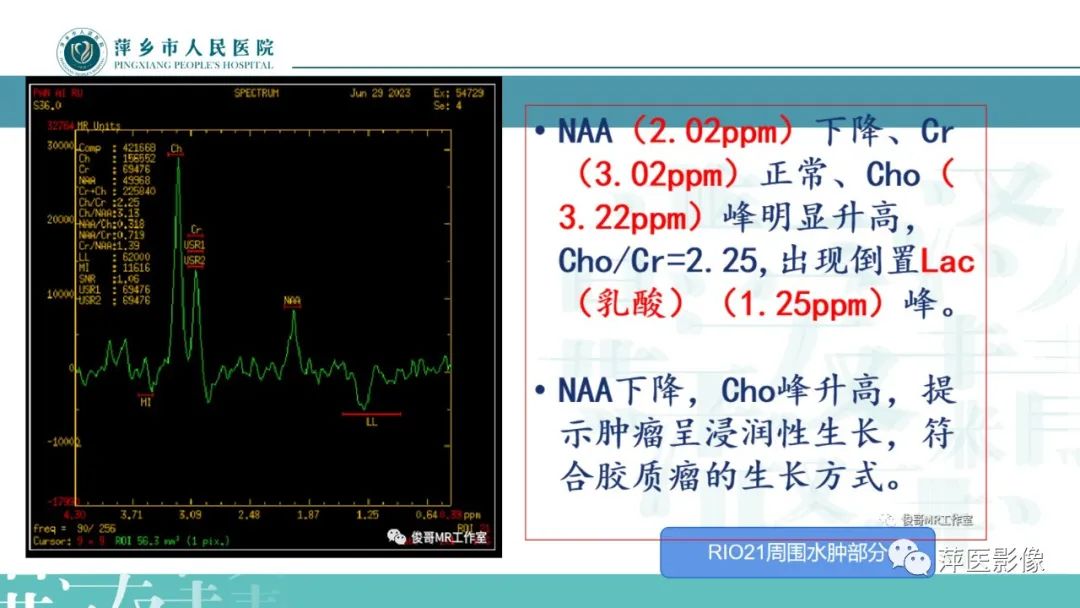 影像PPT - 【PPT】浅析脑肿瘤波谱成像-31