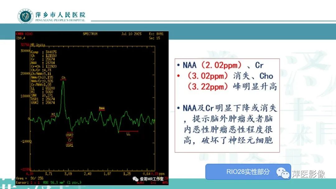 影像PPT - 【PPT】浅析脑肿瘤波谱成像-35