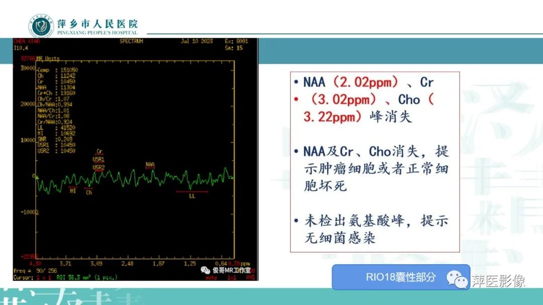 影像PPT - 【PPT】浅析脑肿瘤波谱成像-36