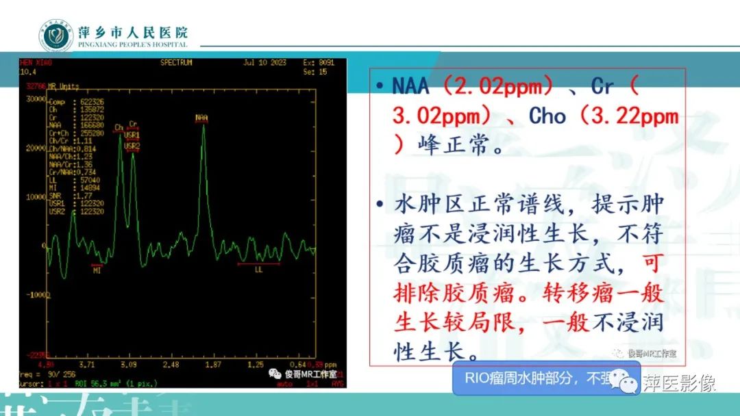 影像PPT - 【PPT】浅析脑肿瘤波谱成像-37
